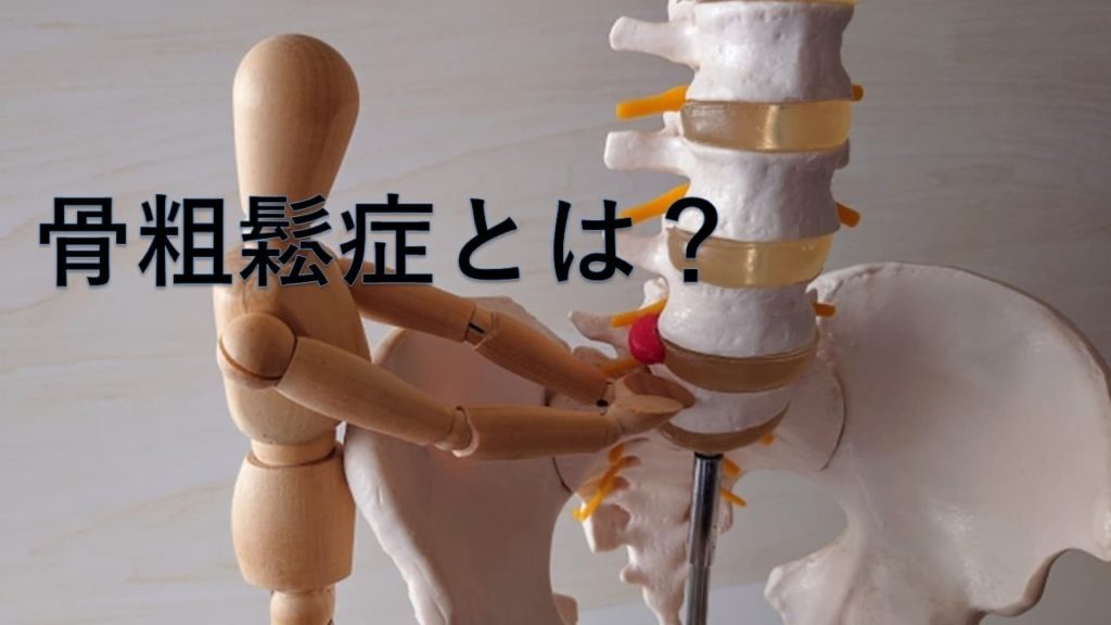 骨粗鬆症とは？